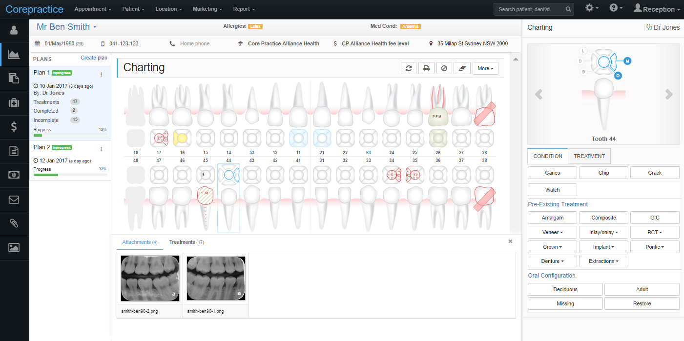 Clinical Charts